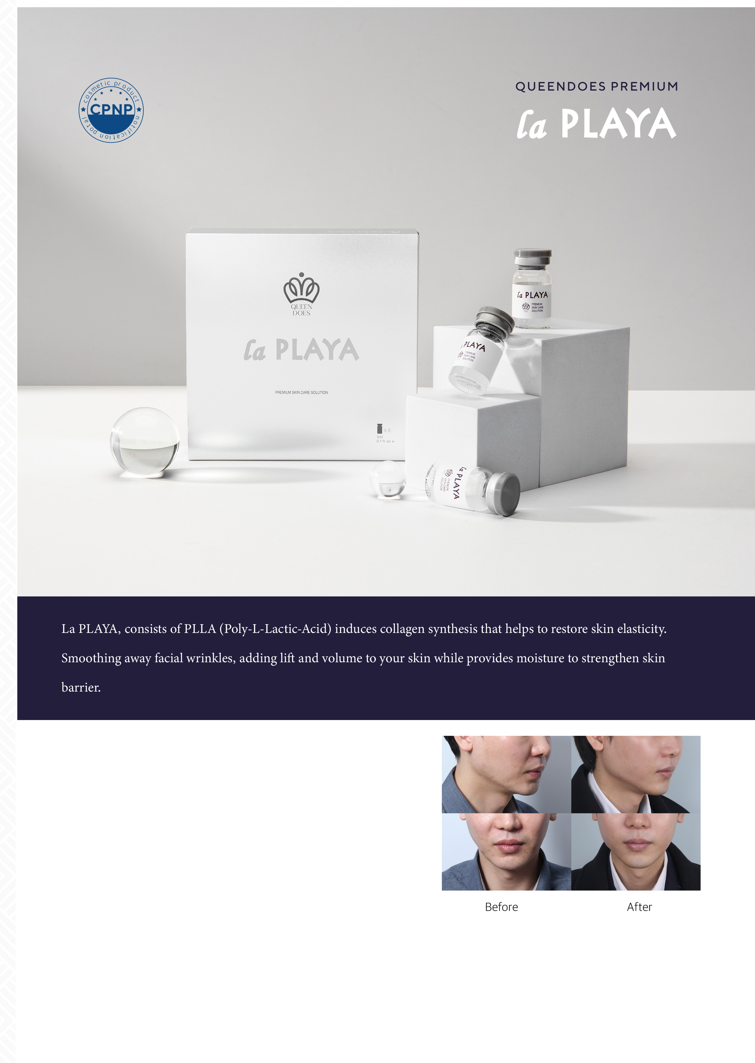 Queendoes PLLA product